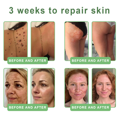 FDA Official: HISKIN® PDRN Multi-Peptide Firming Collagen Body Oil- Anti-aging, Hydrating, Skin Firming & Lifting, Skin Repair, Even Tone, Acne and Dark Spot Treatment, Wart and Mole Removal, and Psoriasis Relief.