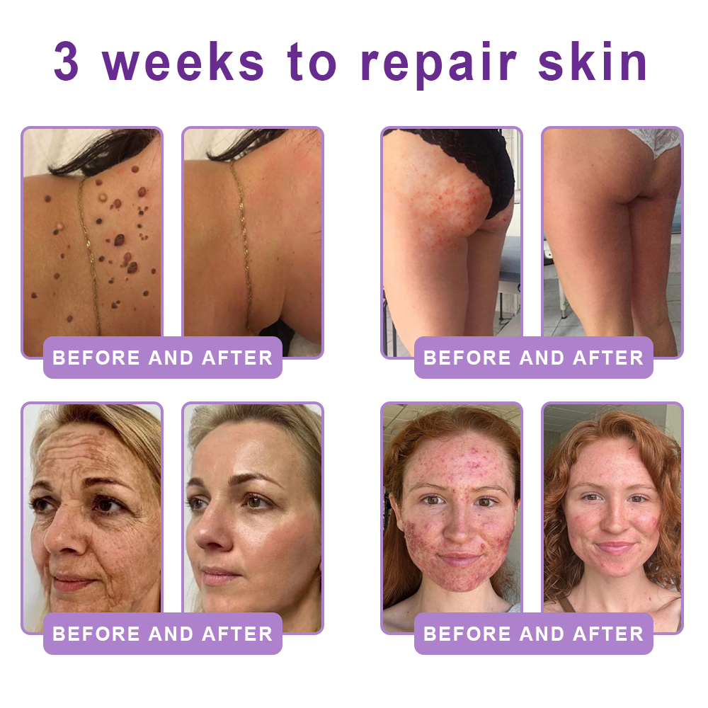 Wake Up Glowing with HISKIN® Deep hydration and radiant-looking skin — every single day.