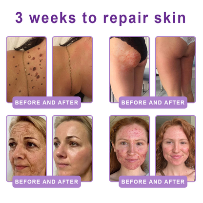 Wake Up Glowing with HISKIN® Deep hydration and radiant-looking skin — every single day.