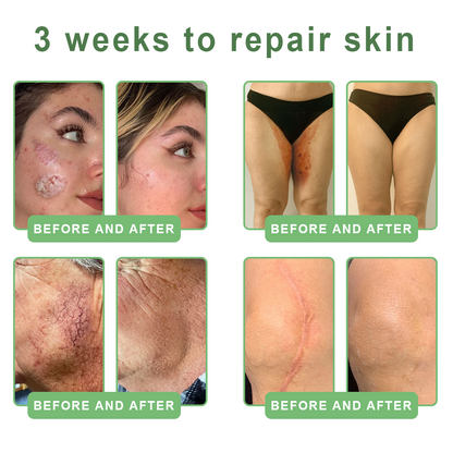 FDA Official: HISKIN® PDRN Multi-Peptide Firming Collagen Body Oil- Anti-aging, Hydrating, Skin Firming & Lifting, Skin Repair, Even Tone, Acne and Dark Spot Treatment, Wart and Mole Removal, and Psoriasis Relief.