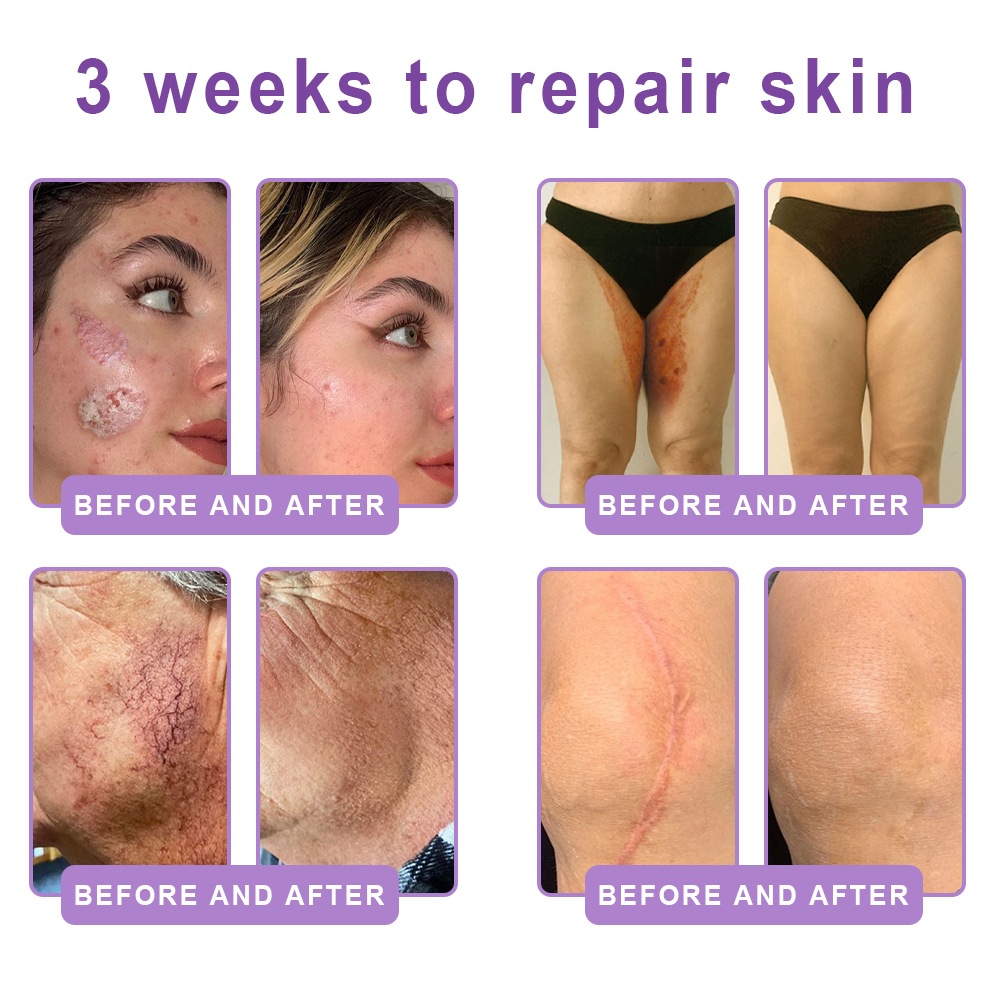 Wake Up Glowing with HISKIN® Deep hydration and radiant-looking skin — every single day.