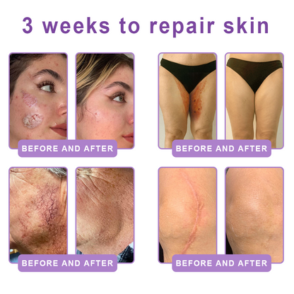 Wake Up Glowing with HISKIN® Deep hydration and radiant-looking skin — every single day.