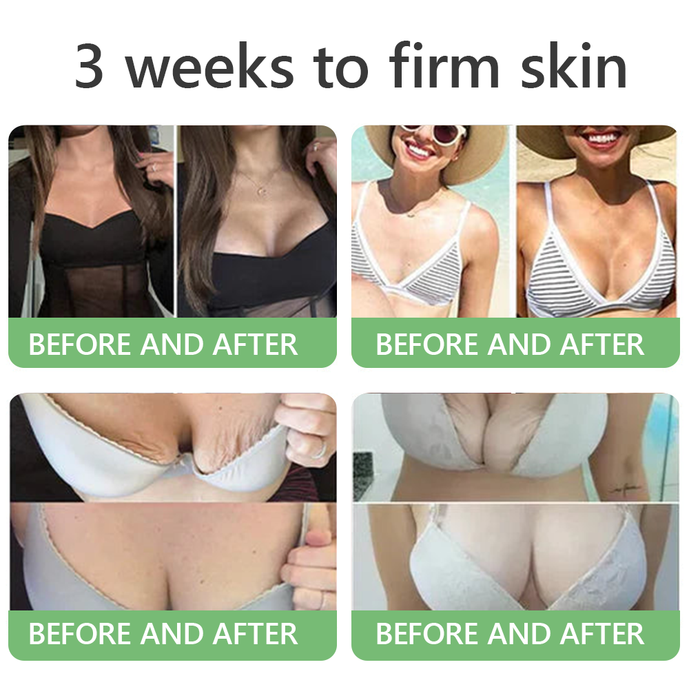 FDA Official: HISKIN® PDRN Multi-Peptide Firming Collagen Body Oil- Anti-aging, Hydrating, Skin Firming & Lifting, Skin Repair, Even Tone, Acne and Dark Spot Treatment, Wart and Mole Removal, and Psoriasis Relief.