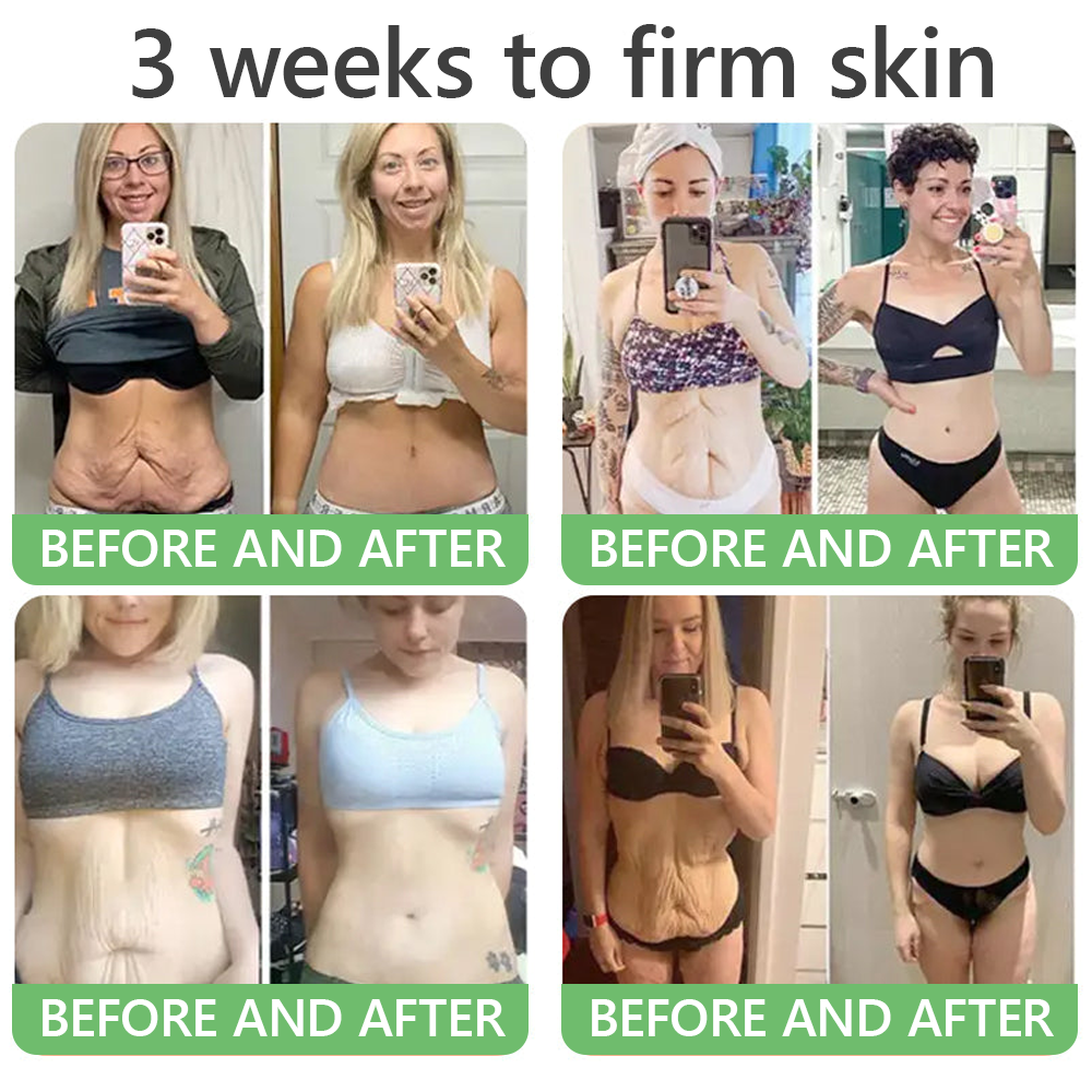 FDA Official: HISKIN® PDRN Multi-Peptide Firming Collagen Body Oil- Anti-aging, Hydrating, Skin Firming & Lifting, Skin Repair, Even Tone, Acne and Dark Spot Treatment, Wart and Mole Removal, and Psoriasis Relief.