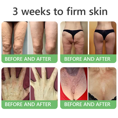 FDA Official: HISKIN® PDRN Multi-Peptide Firming Collagen Body Oil- Anti-aging, Hydrating, Skin Firming & Lifting, Skin Repair, Even Tone, Acne and Dark Spot Treatment, Wart and Mole Removal, and Psoriasis Relief.