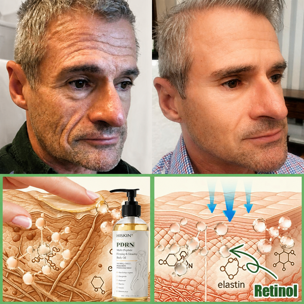 FDA Official: HISKIN® PDRN Multi-Peptide Firming Collagen Body Oil- Anti-aging, Hydrating, Skin Firming & Lifting, Skin Repair, Even Tone, Acne and Dark Spot Treatment, Wart and Mole Removal, and Psoriasis Relief.