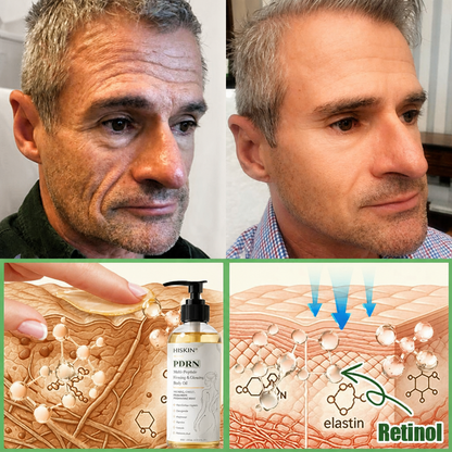 FDA Official: HISKIN® PDRN Multi-Peptide Firming Collagen Body Oil- Anti-aging, Hydrating, Skin Firming & Lifting, Skin Repair, Even Tone, Acne and Dark Spot Treatment, Wart and Mole Removal, and Psoriasis Relief.